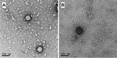 Introducing a Novel, Broad Host Range Temperate Phage Family Infecting Rhizobium leguminosarum and Beyond